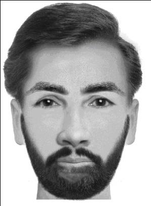 دموی سر، داڑھی اور بال
